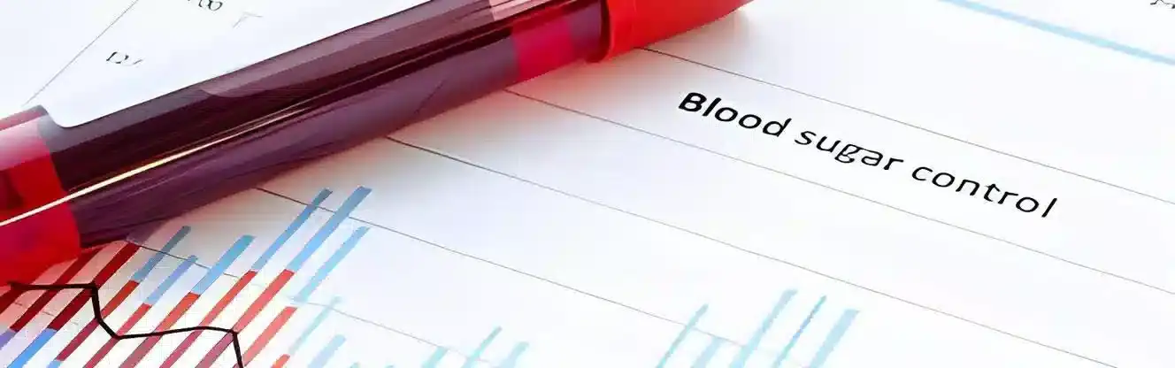 آزمایش قند خون در منزل اندیشه تهران