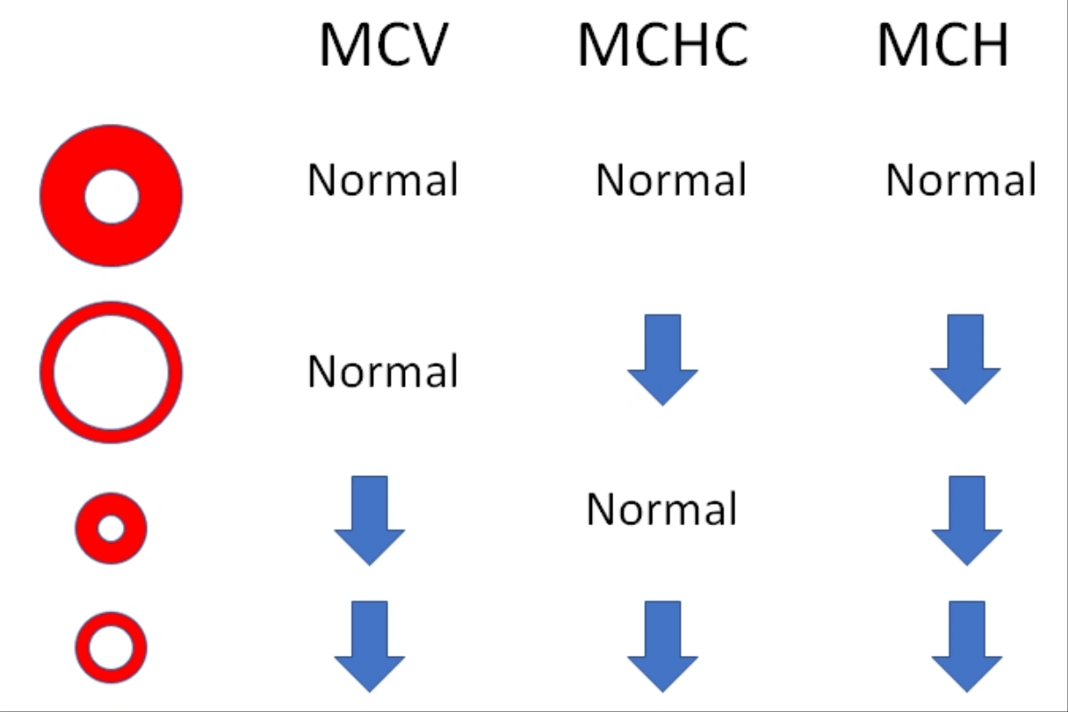 MCV، MCH، MCHC و RDW