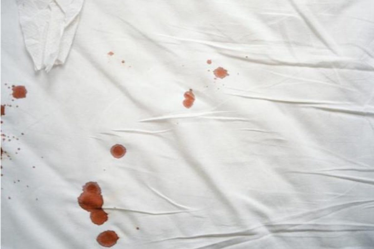 لکه های خون روی سرویس خواب