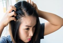 ترفندهای مهم جلوگیری از ریزش مو مردان و زنان