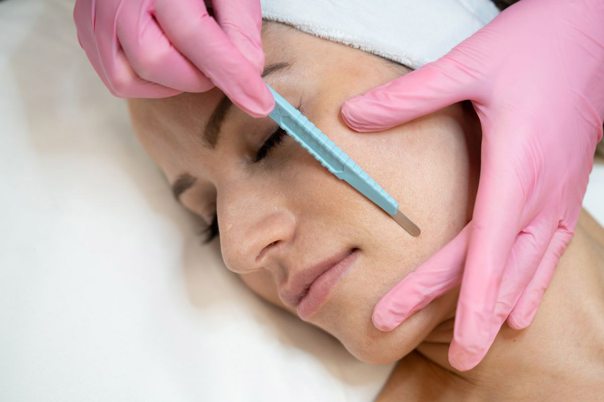 درماپلنینگ؛ یک روش مؤثر برای اصلاح موی صورت 