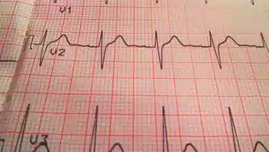 آموزش تفسیر نوار قلب به زبان ساده