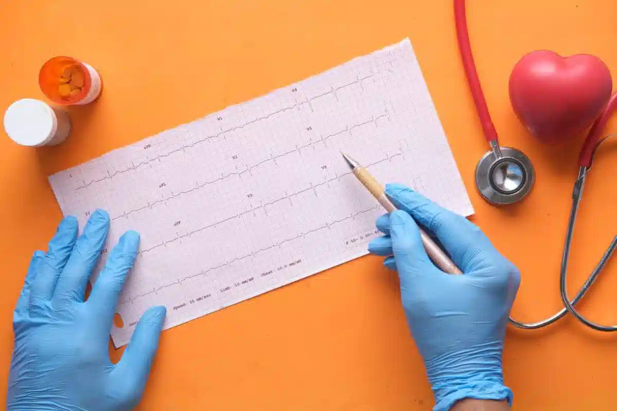نوار ECG