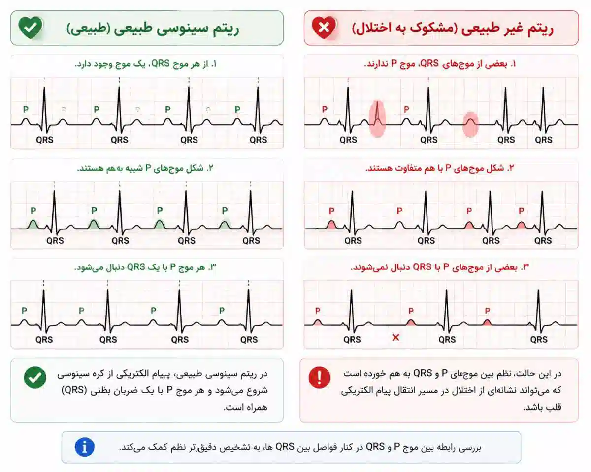ریتم طبیعی و غیرطبیعی قلب