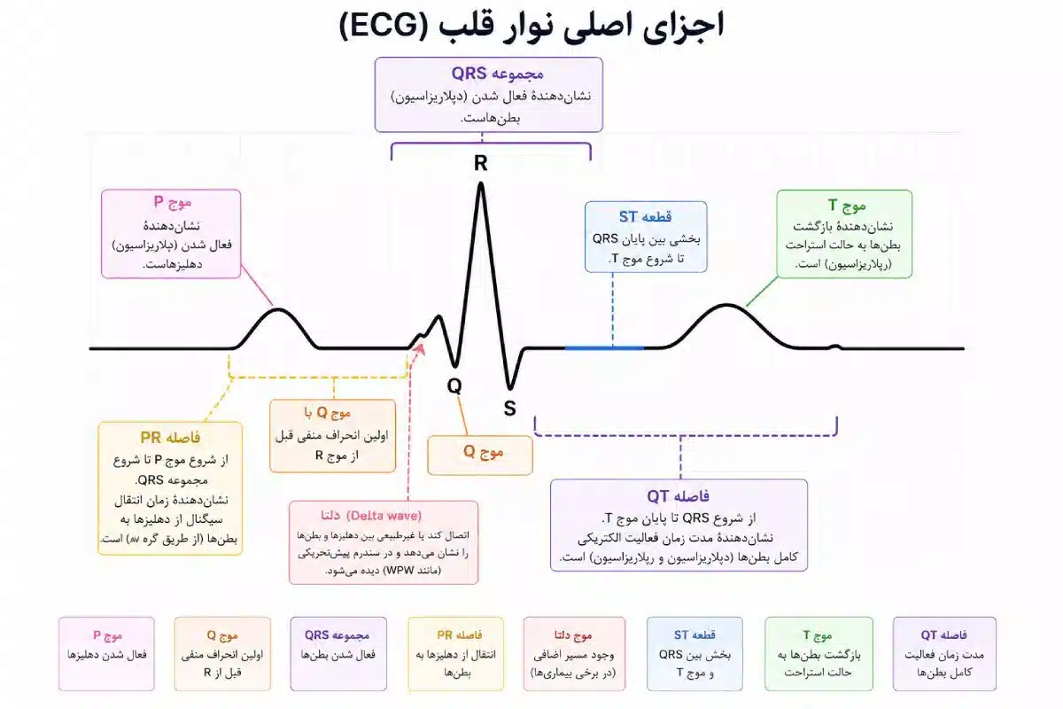 تفسیر نوار قلب برای پرستاران
