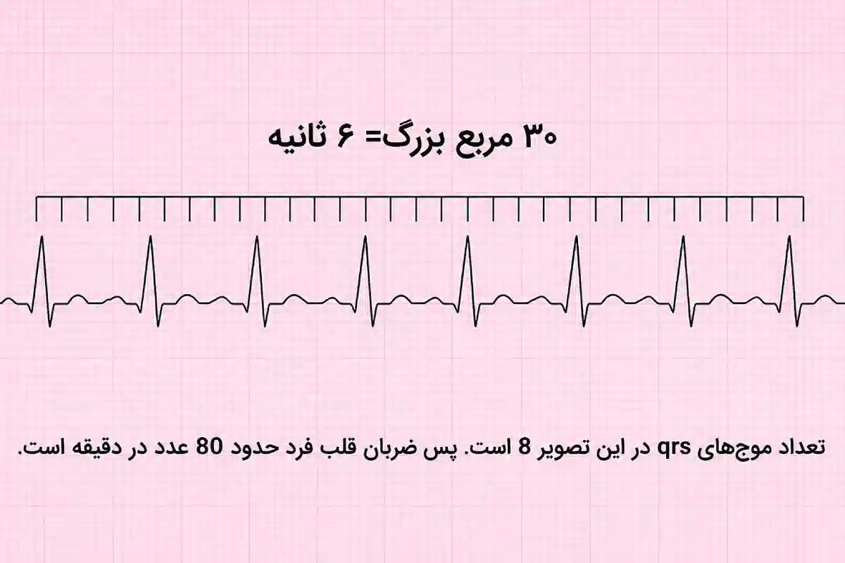 شمارش تعداد موج‌های QRS برای پیدا کردن ضربان قلب