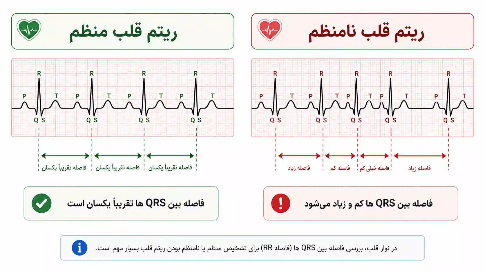 عکس نوار قلب سالم و ناسالم