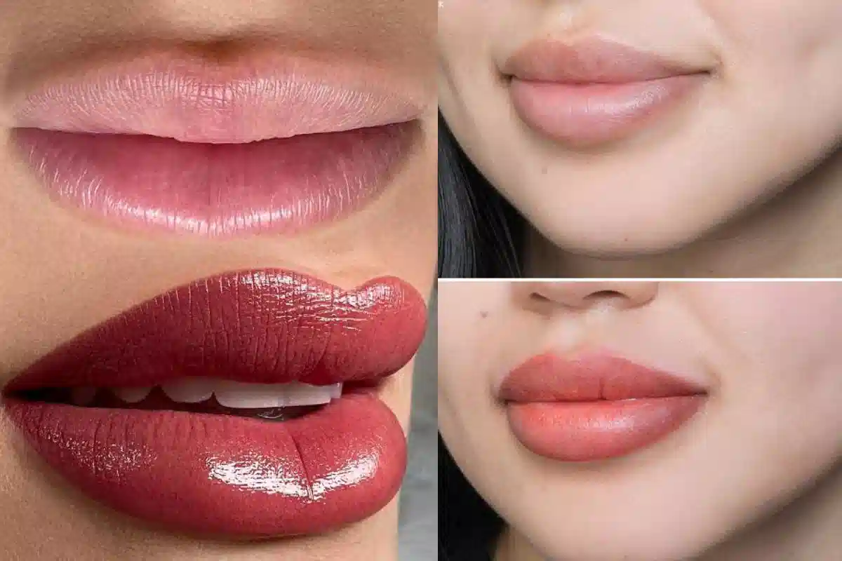 نتیجه شیدینگ بعد از یک ماه