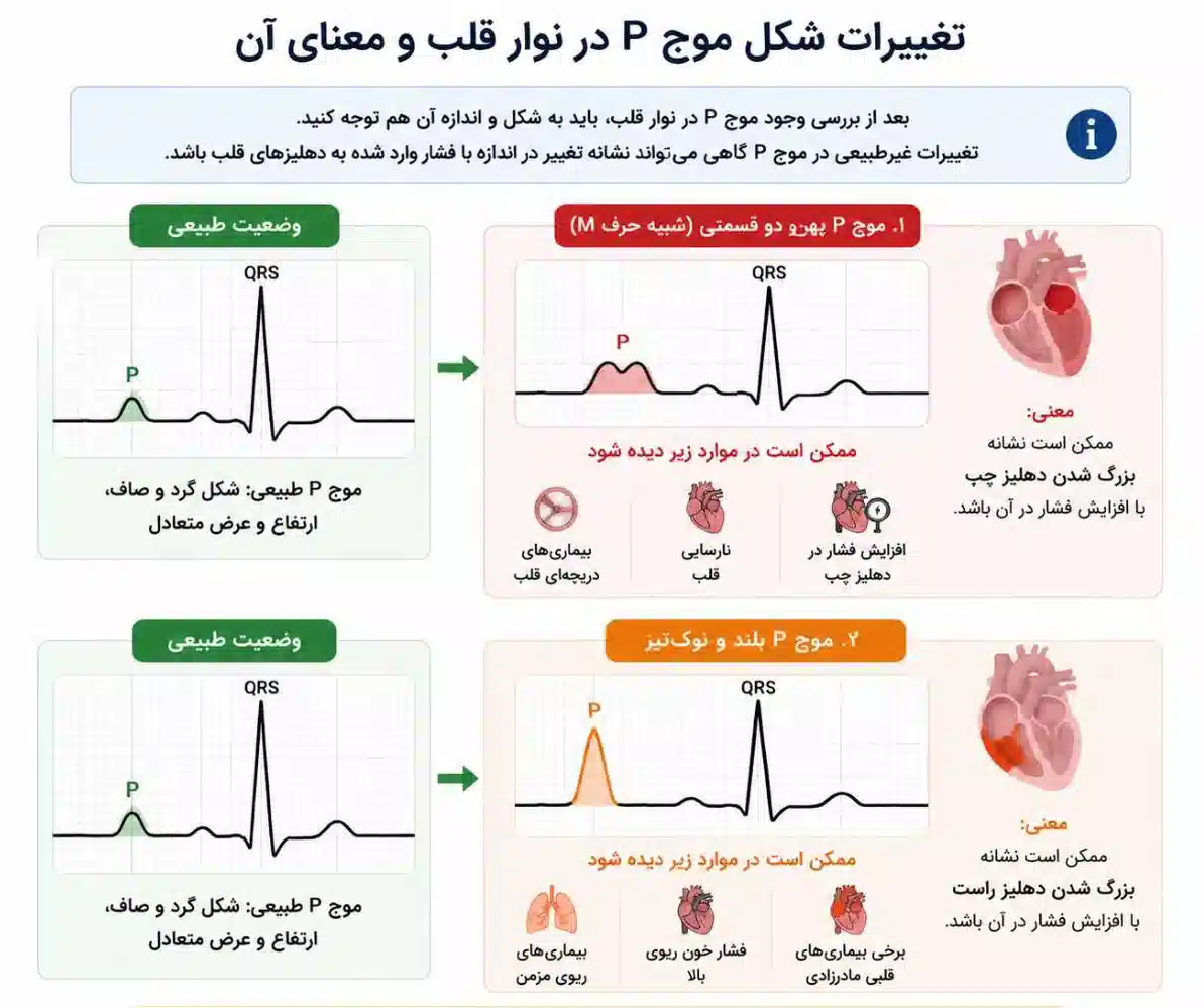 نوار قلب خطرناک